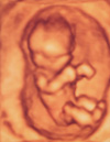 写真：妊娠12週 子宮の中の赤ちゃん