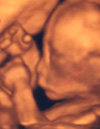 写真：妊娠22週 表情や指の様子が分かります